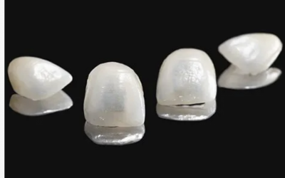 ¿Qué son las Carillas Dentales y cómo Funcionan?