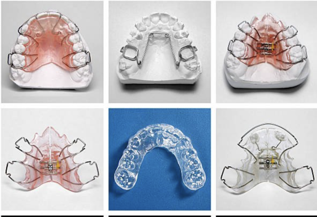 ortopedia-maxilar-en-queretaro-clinica-oralmaxq