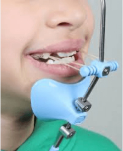 ortopedia-y-ortodoncia-clinica-oralmaxq