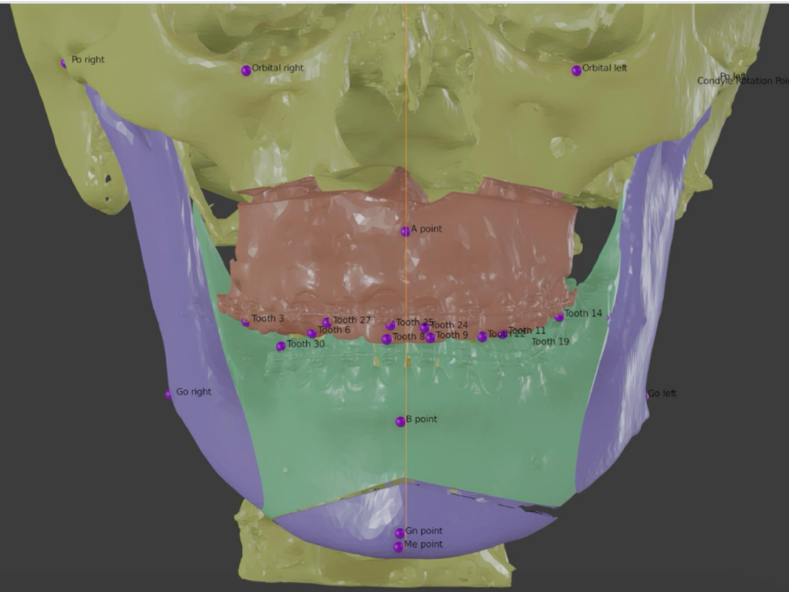 cirugia-ortognatica-clinica-oralmaxq