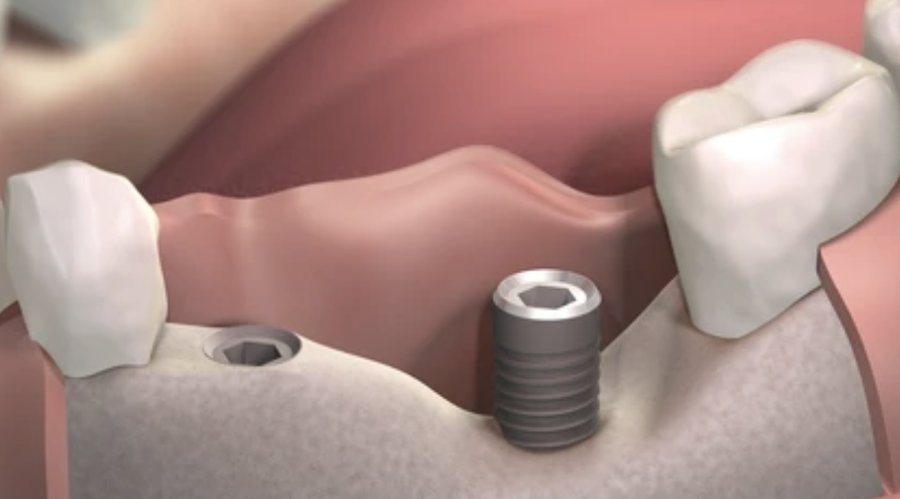 diagnostico-periodontal-clinica-oralmaxq
