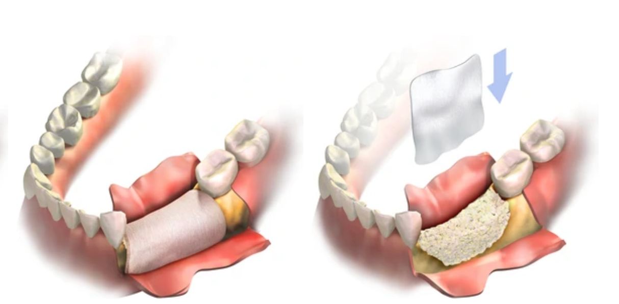 periodoncia