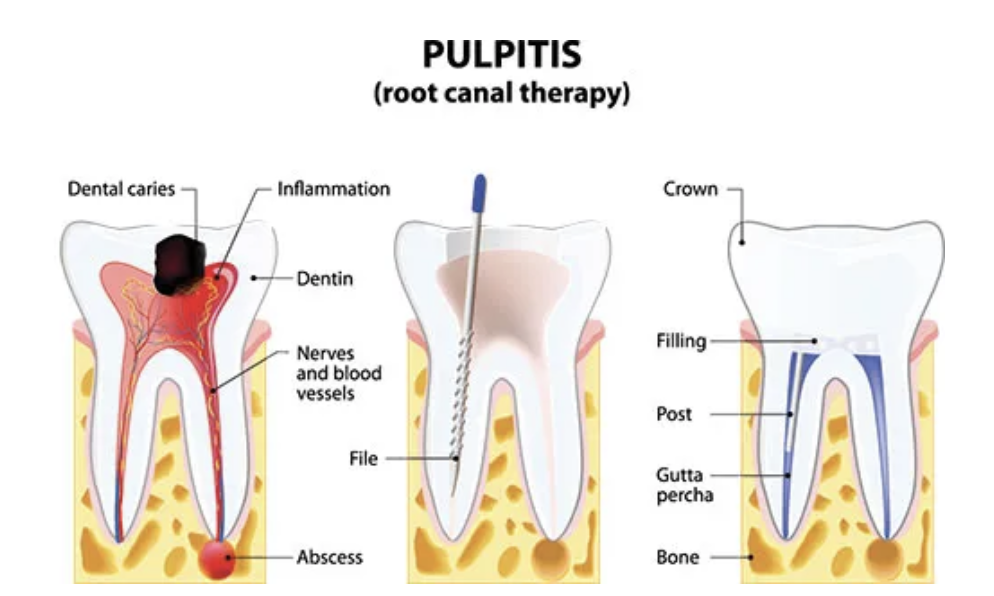 Especialistas en Endodoncias