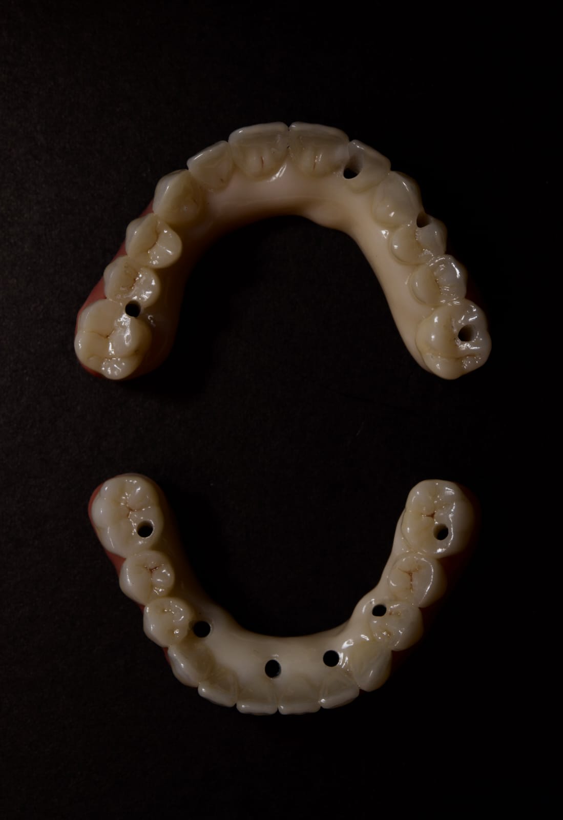 que-es-un-tratamiento-all-on-x-clinica-oralmaxq