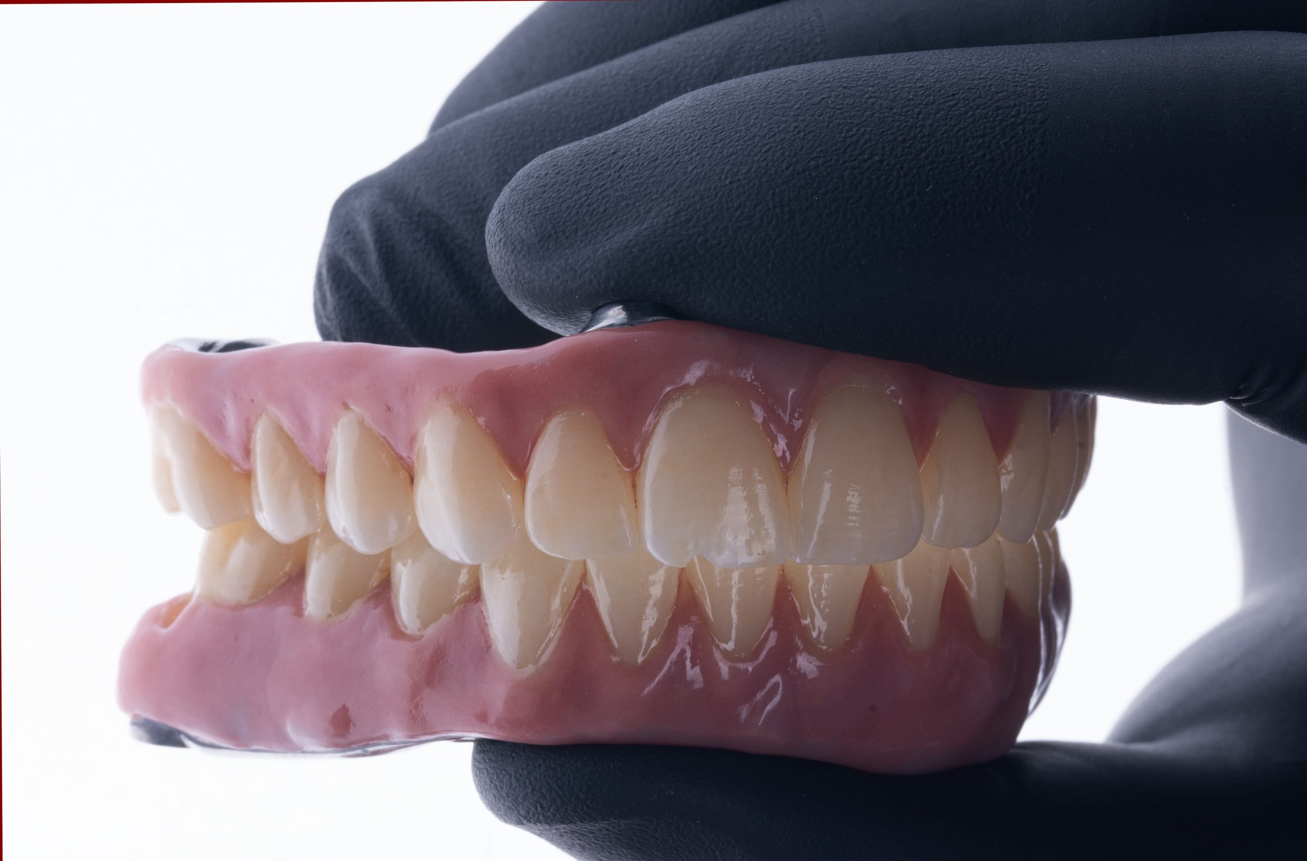 que-es-un-tratamiento-all-on-x-clinica-oralmaxq