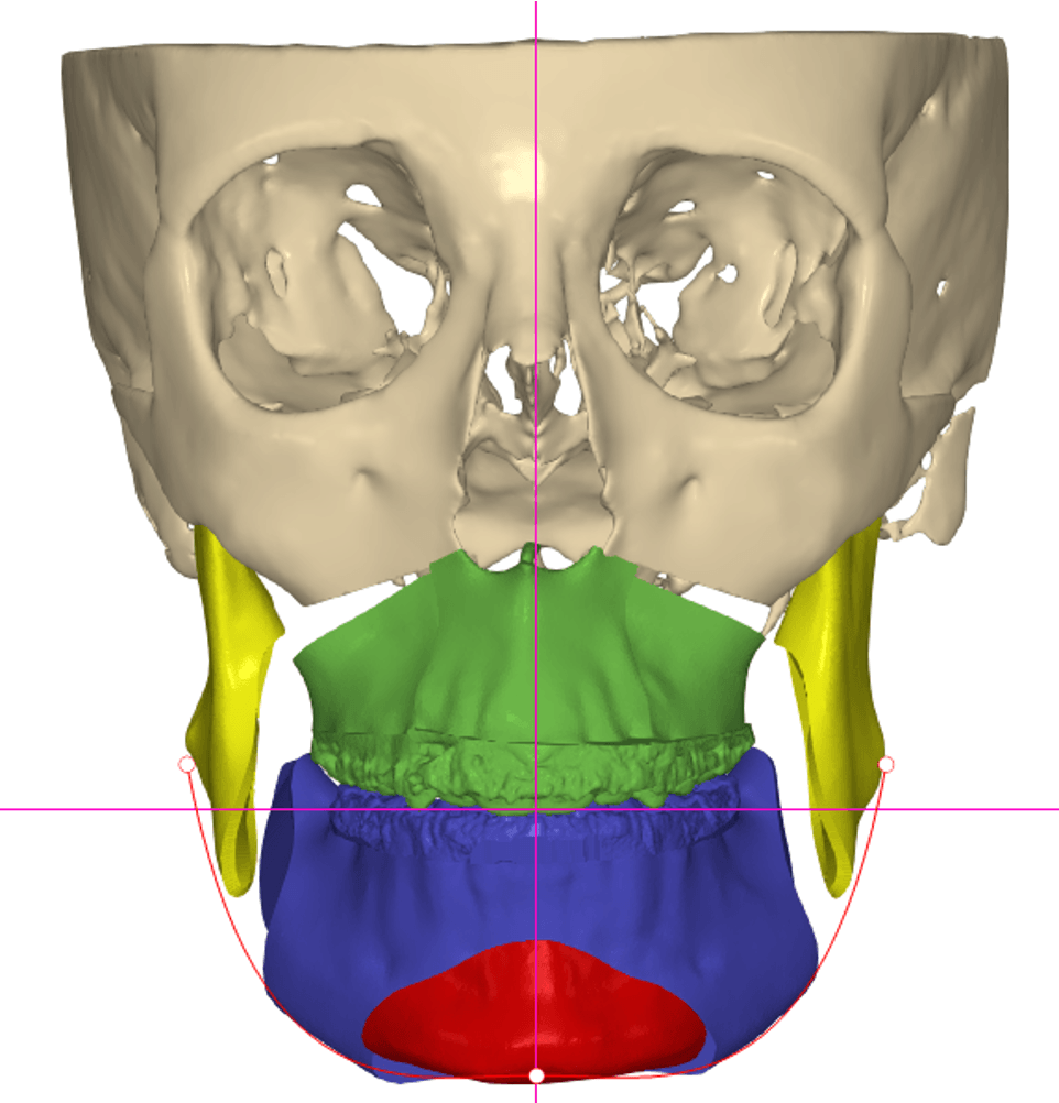 cuando-se-trabaja-en-conjunto-ortodoncia-cirugia-ortognatica-clinica-oralmaxq