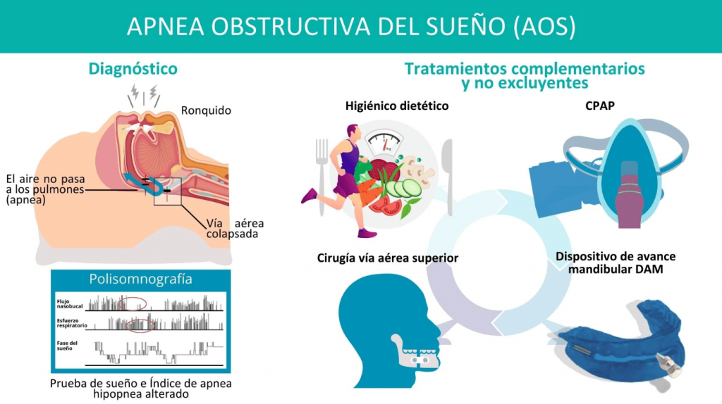 que-tratamientos-existen-para-el-saos-clinica-oralmaxq