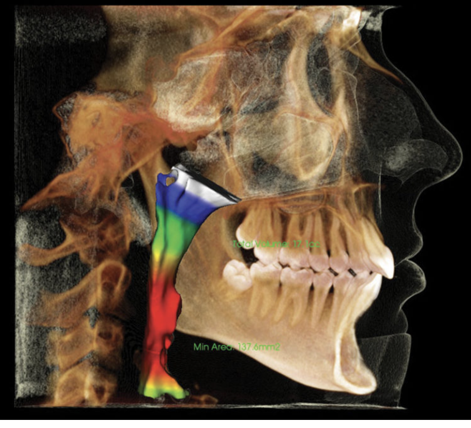 evaluación-de-los-maxilares-via-aerea-clinica-oralmaxq