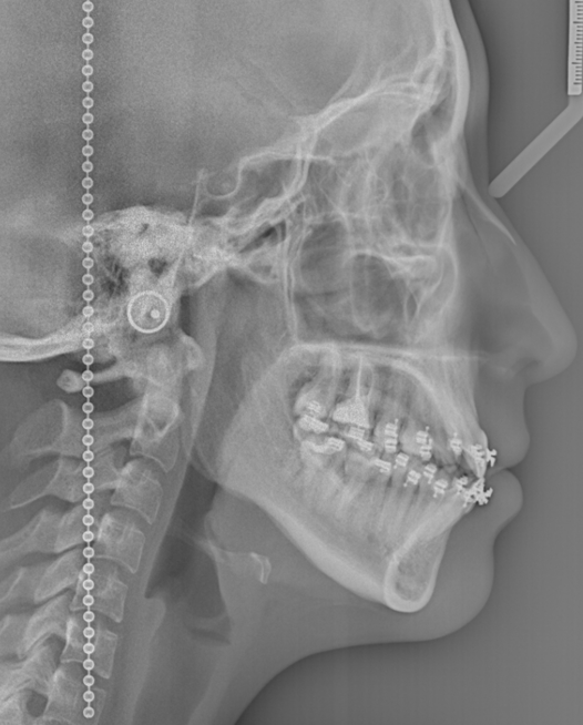 via-aerea-antes-de-cirugia-clinica-oralmaxq
